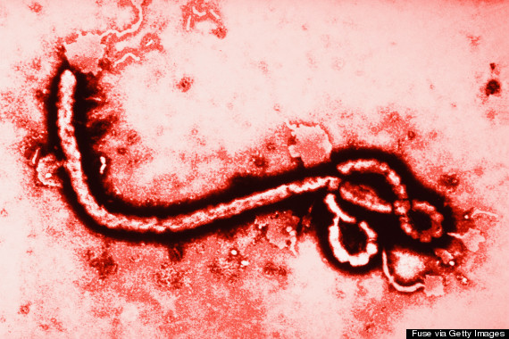 Qué es el Ébola, síntomas, transmisión y prevención