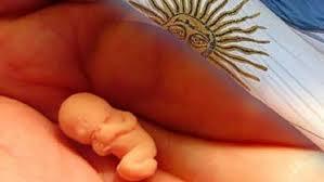 En nuestro país, aborto no punible