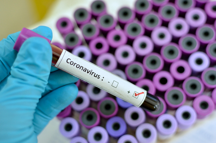 Coronavirus en la provincia: murió joven de 28 años y cifra máxima de 68 casos