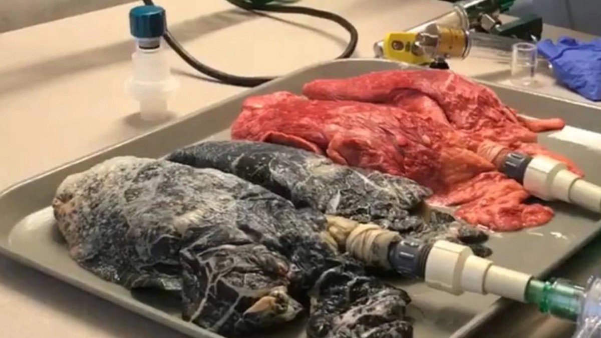 Salud: 45 mil personas mueren por año en Argentina por el consumo de tabaco